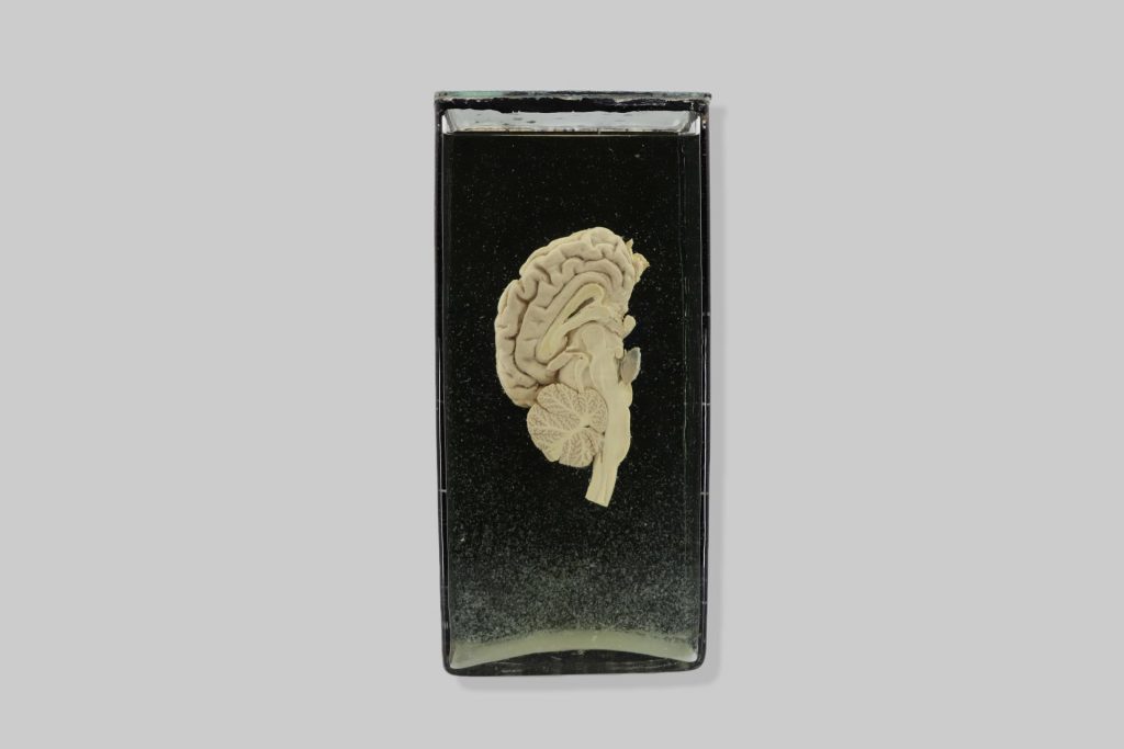 Veliki mozak (cerebrum), mali mozak (cerebellum) i moždano deblo (truncus encephali)