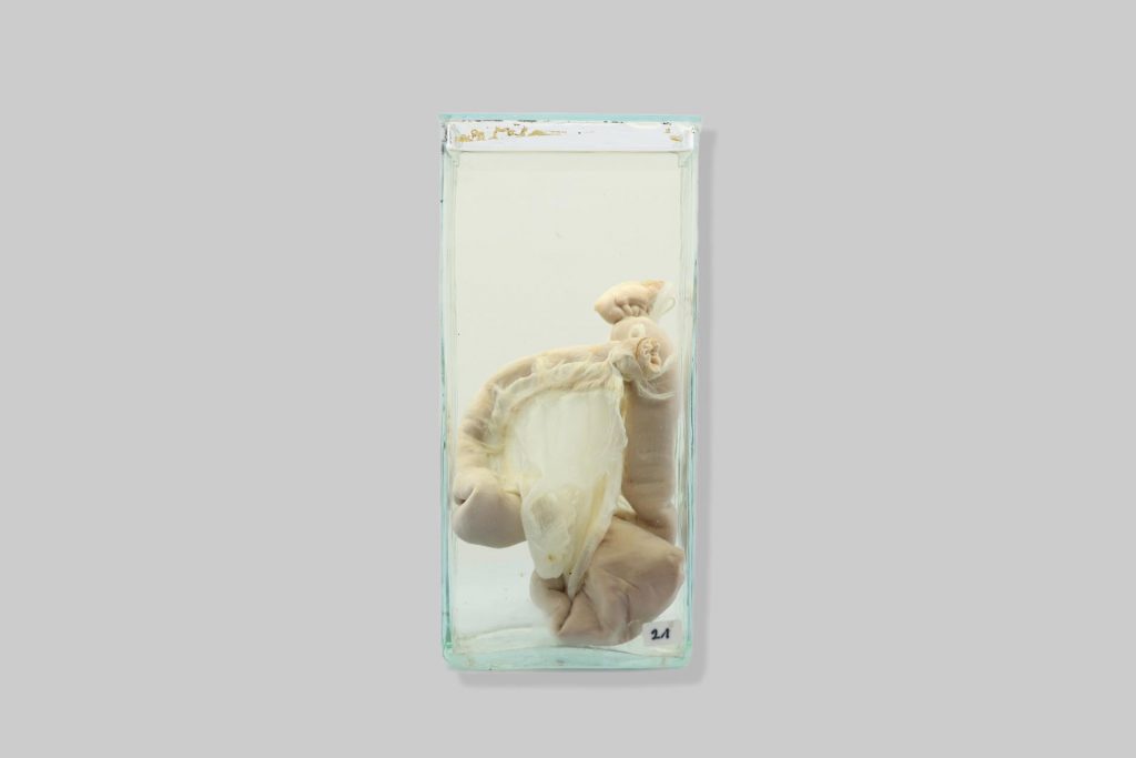 Tanko crijevo (intestinum tenue)