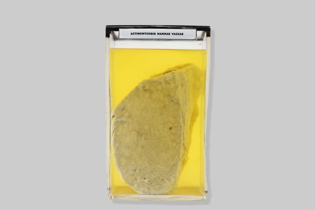 Actinomycosis mammae vaccae