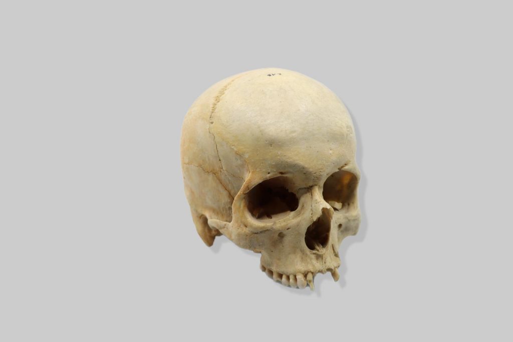 Čovjek (Homo sapiens)
