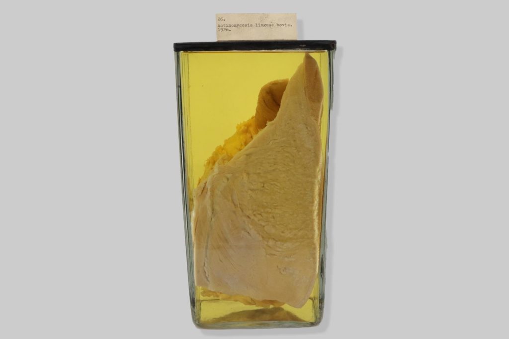 Actinomycosis lingue bovis