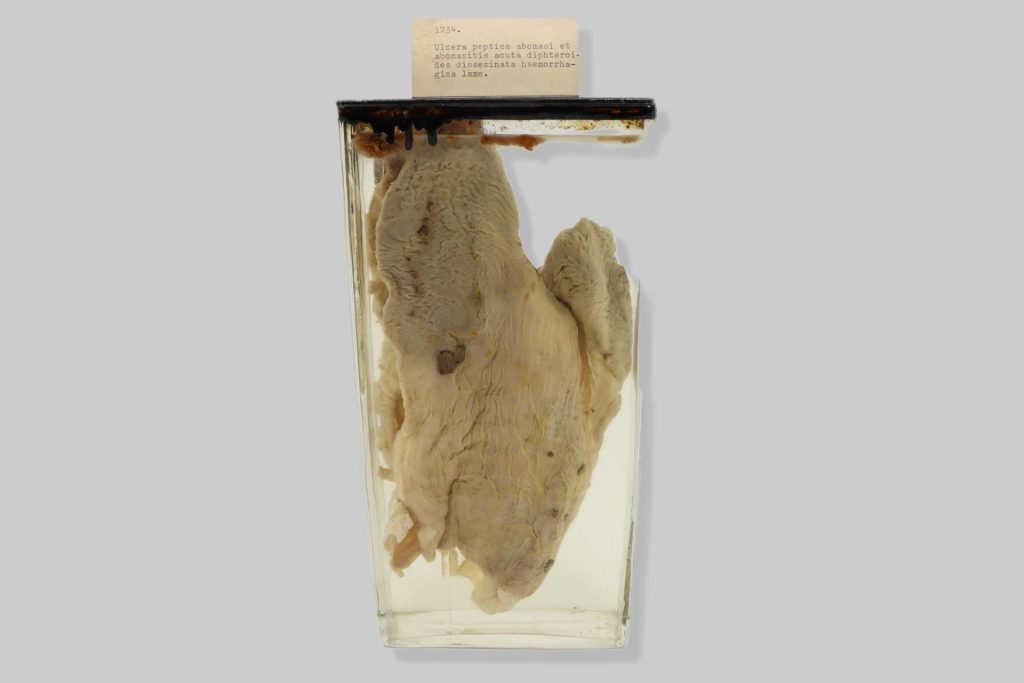 Ulcera peptica abomasi et abomasitis acuta diphteroides disseminata haemorrhagica lame