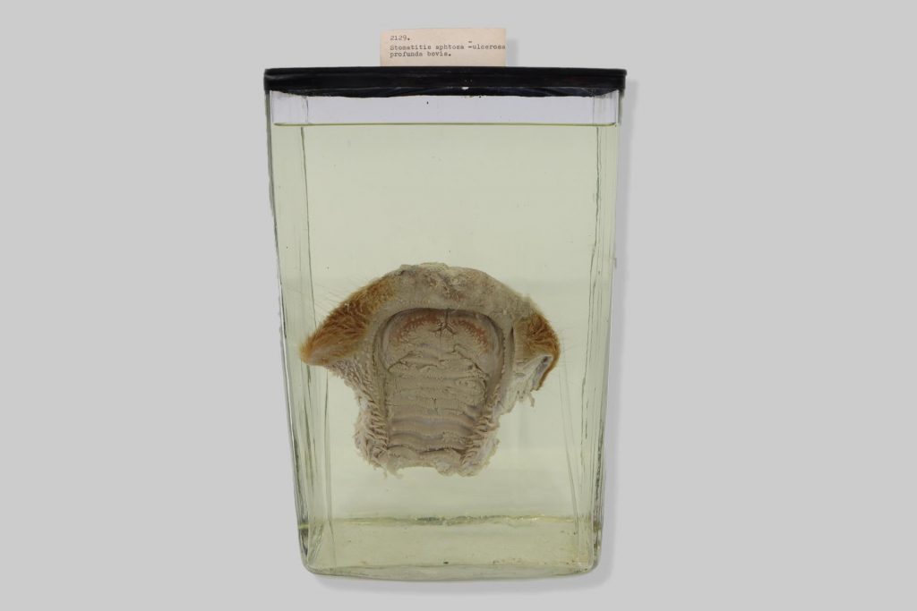 Stomatitis aphtosa-ulcerosa profunda bovis