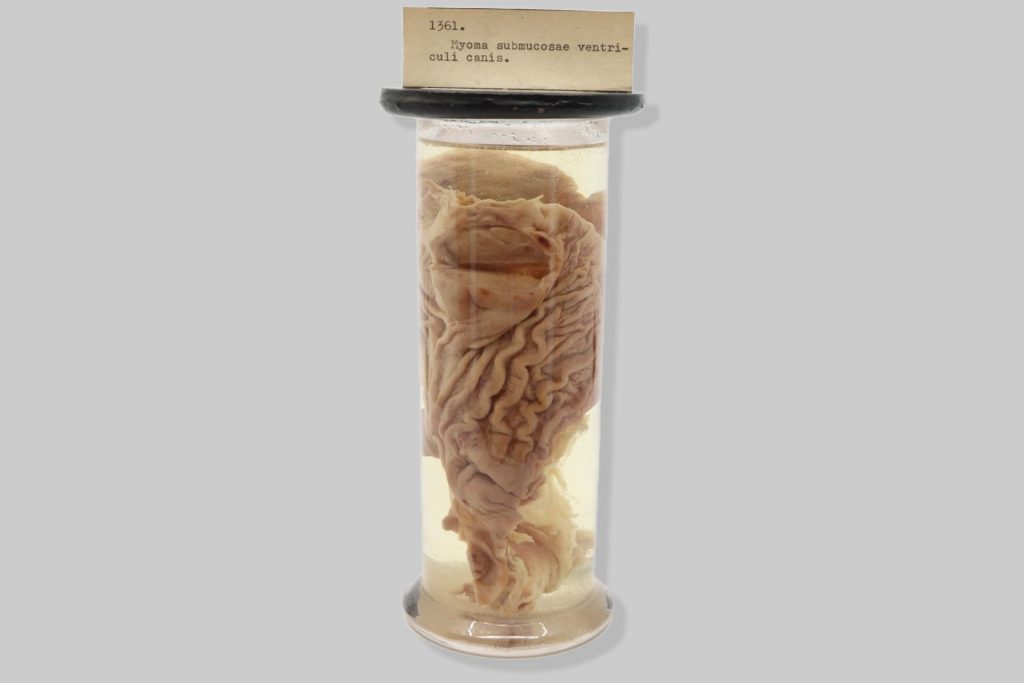 Ulcus tuberculosum chronicum ventriculi hominis