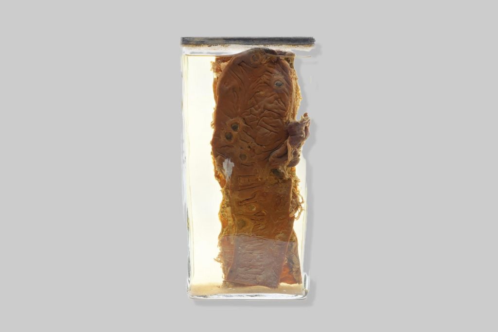 Typhlitis et colitis follicularis diphteroides suis. Pestis suum.