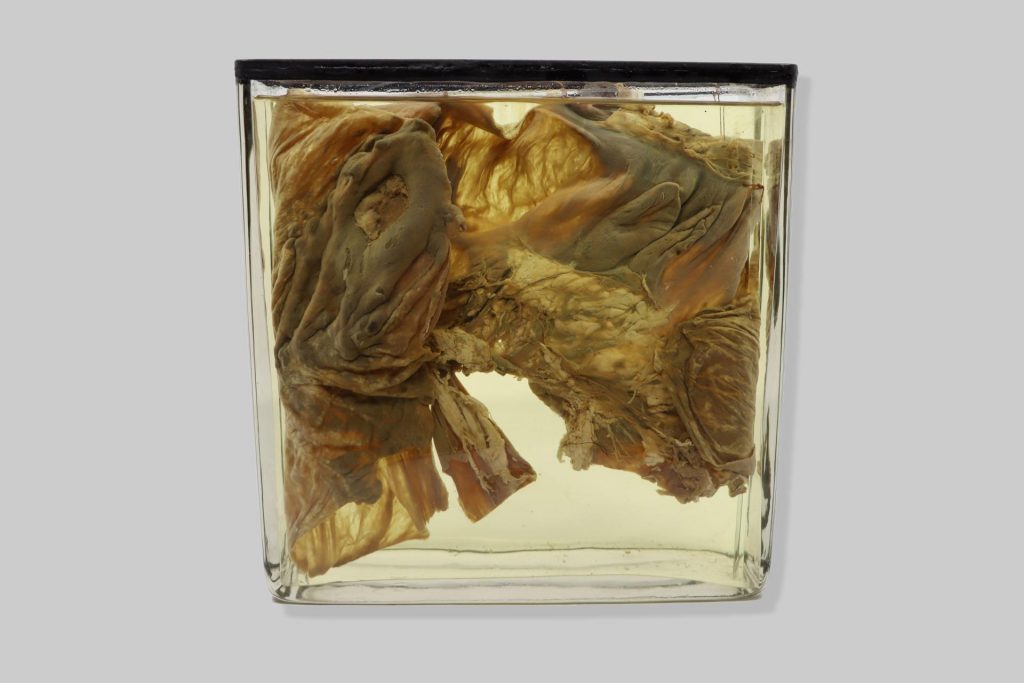 Sclerostomiasis intestini coeci equi