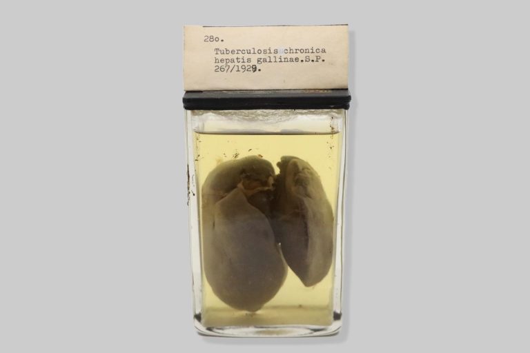 Tuberculosis chronica hepatis gallinae