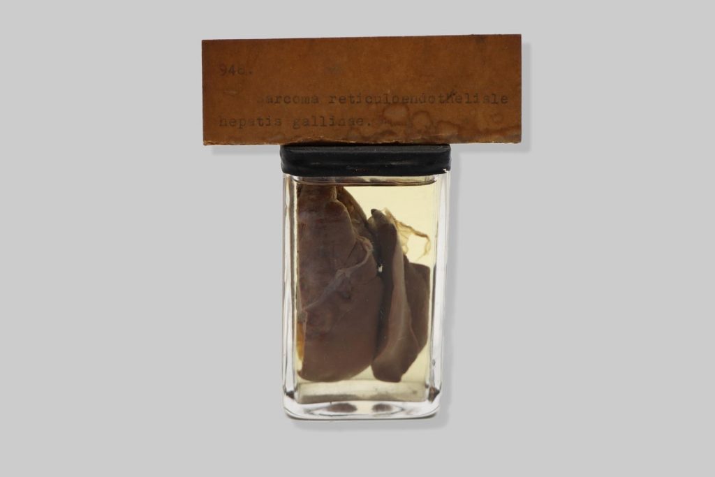 Sarcoma reticuloendotheliale hepatis gallinae