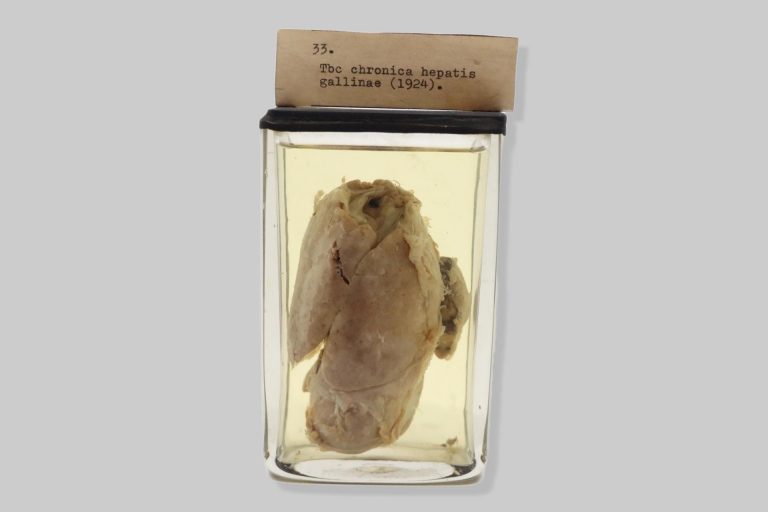 Tuberculosis chronica hepatis gallinae