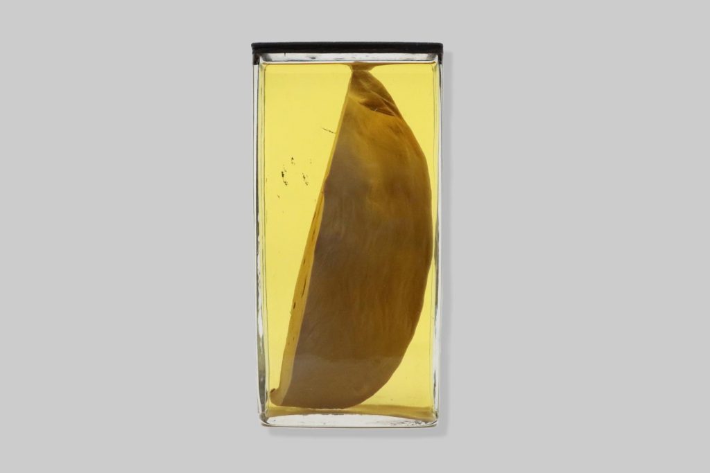 Abscessus hepatis disseminati equi. Adenitis equorum.
