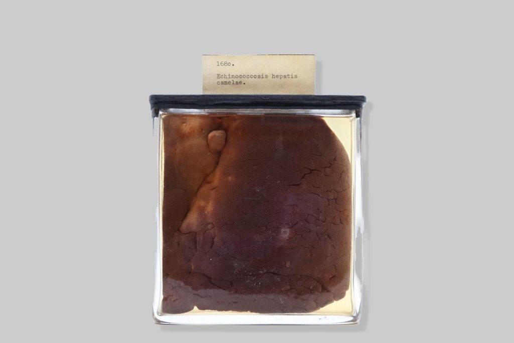 Echinococcosis hepatis camelae