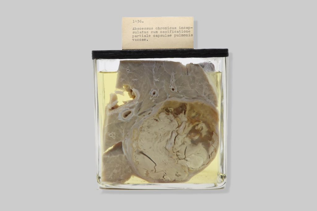 Abscessus chronicus incapsulatus cum ossificatione partiale capsulae pulmonis vaccae