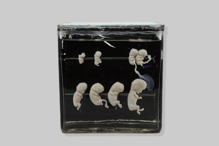 Razvojni stadiji embrija/fetusa čovjeka / developmental stages of human embryo / fetus (Homo sapiens)