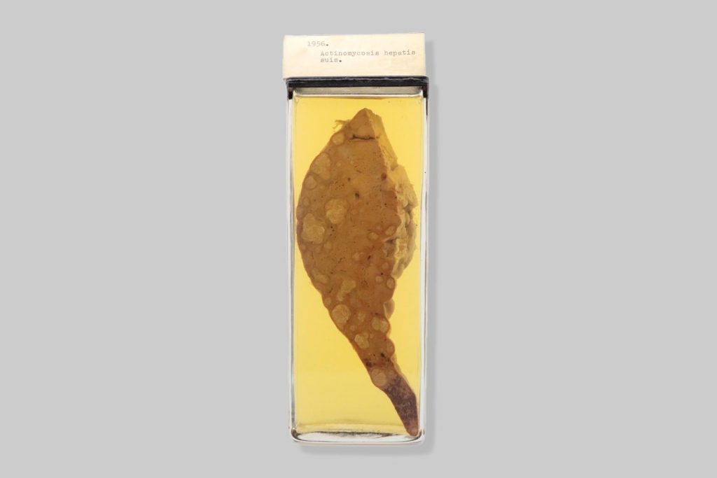 Actinomycosis hepatis suis