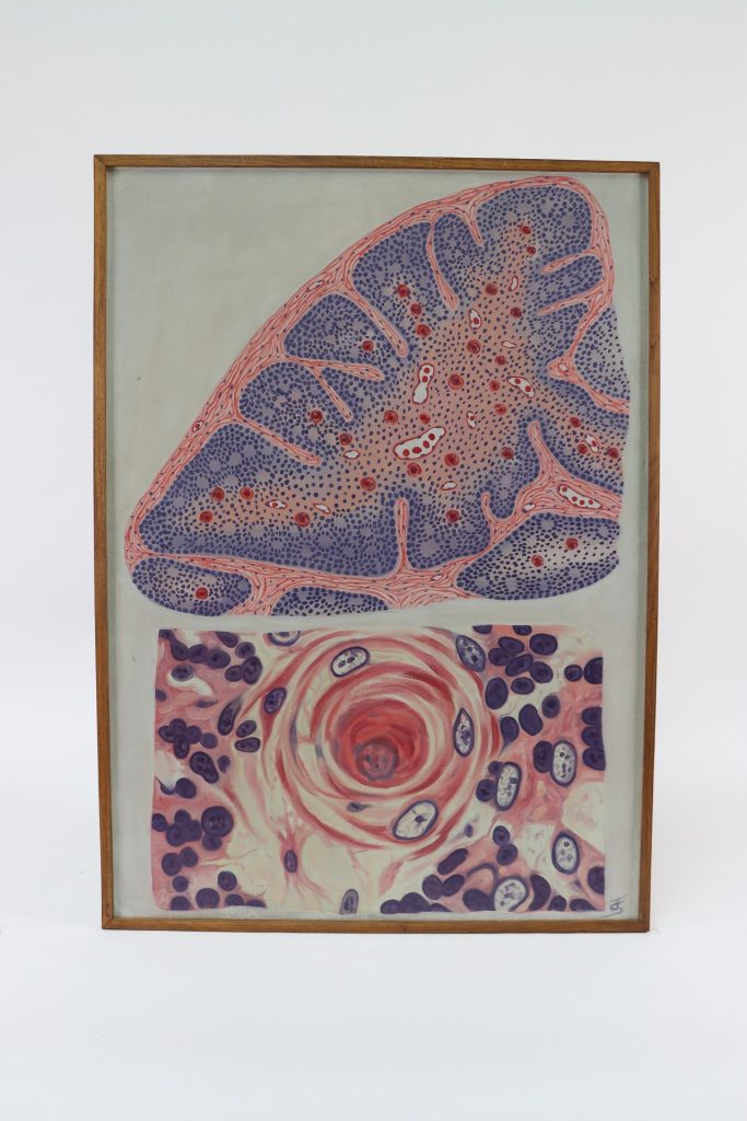 Timus / thymus (thymus)